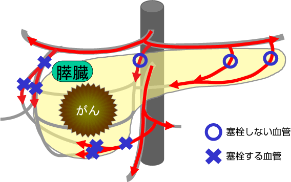 X͓ǐp(TPPAE)