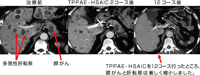 wÖ@(HSAIC,SAIC)